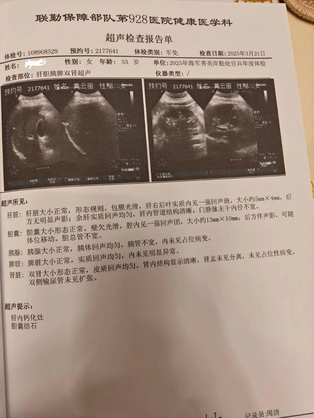 左右→黄云丽2025年3月21日的体检报告单更令人欣喜的是,我的 胰艘 