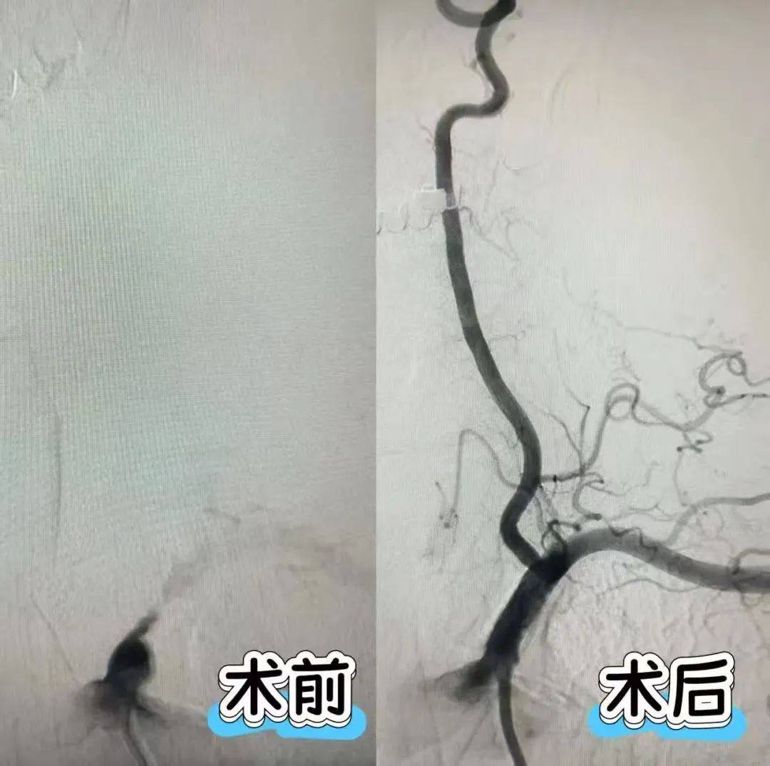 关于北京阜外医院、全程陪同网上代挂专家号，在线客服为您解答的信息