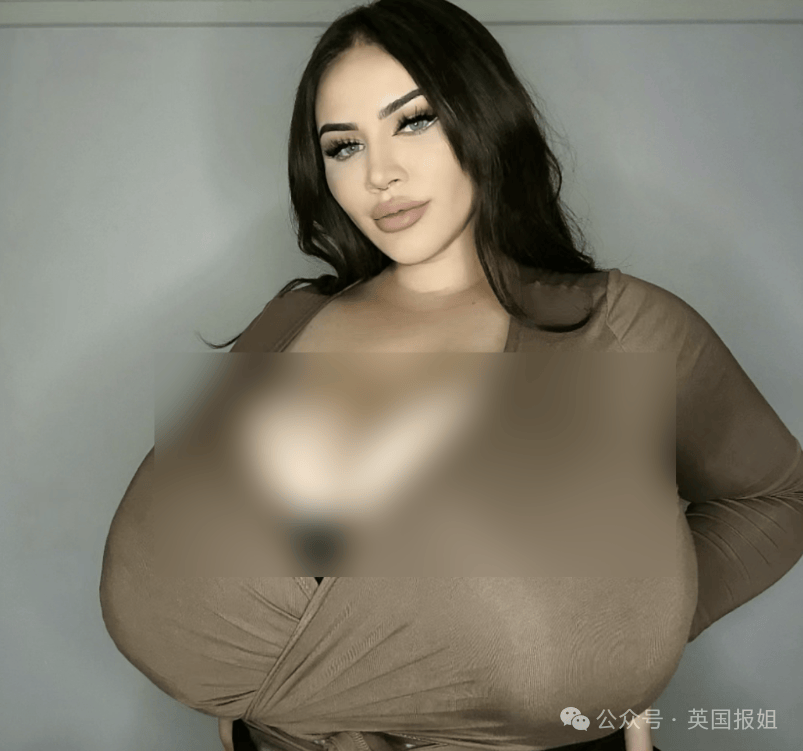 巴西美女得怪病胸部暴涨到24斤?