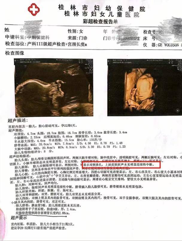 桂林女子称彩超漏诊婴儿唇裂，到卫健委反映问题竟遭怒斥，涉事医院：彩超未看出任何问题
