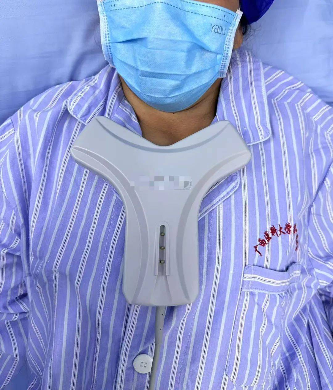 我院完成广西首例肿瘤+高颅压3cg磁导航picc置管新技术
