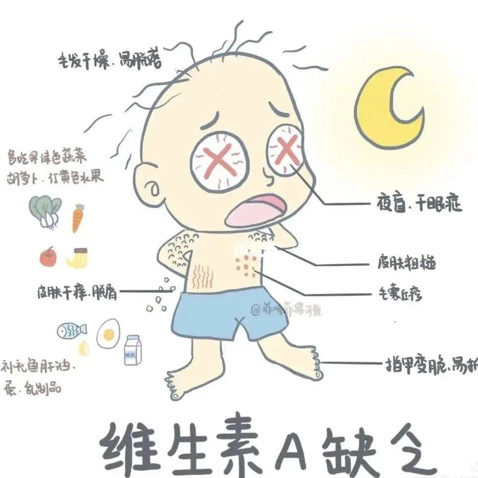 【981医院·科普讲堂】维生素缺乏——潜藏在身体里的健康警报_人群_症状_患者