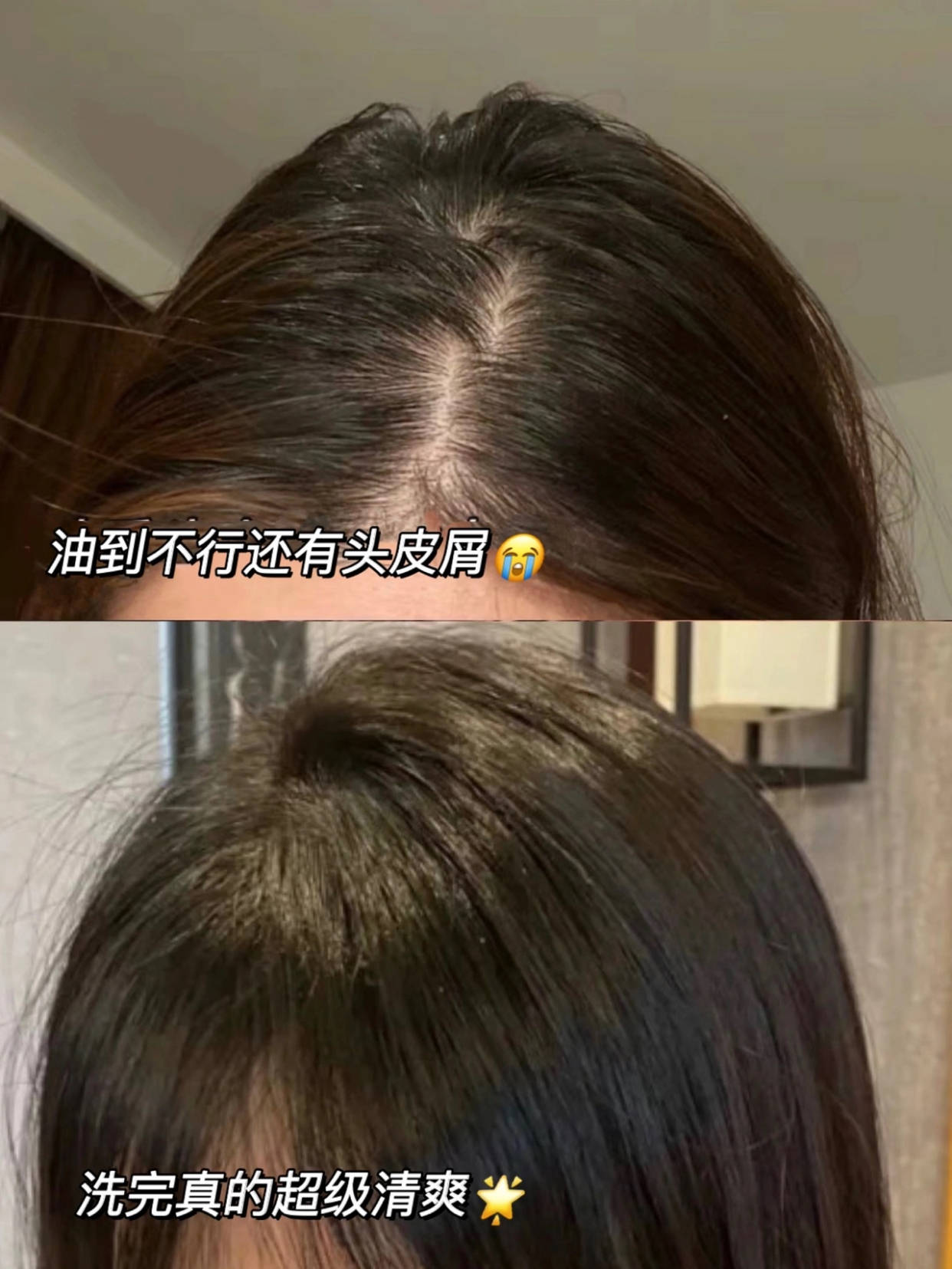 去屑防脱实测专利洗发水