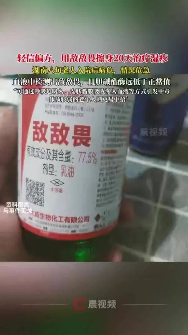 輕信偏方，用敵敵畏擦身治濕疹！20天后八旬老人病危了……專(zhuān)家緊急提醒