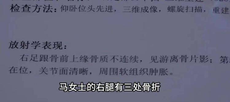 共享单车突然自动落锁？女子严重摔伤！多地均有发生