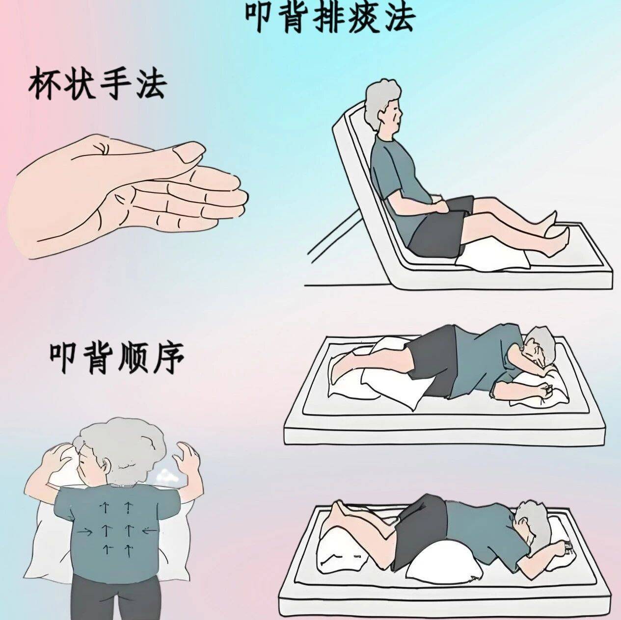 【健康科普】科学叩背排痰——舒畅呼吸_患者_操作_进行