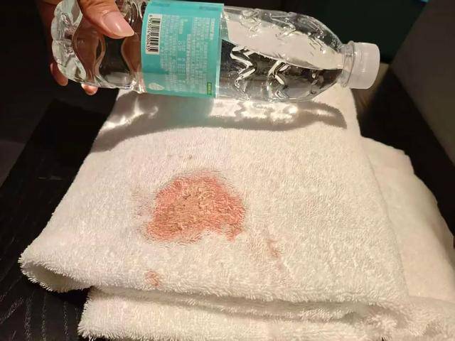 男子发现希岸酒店浴巾有大片血迹担心染病要求赔偿 网友热议(图1)