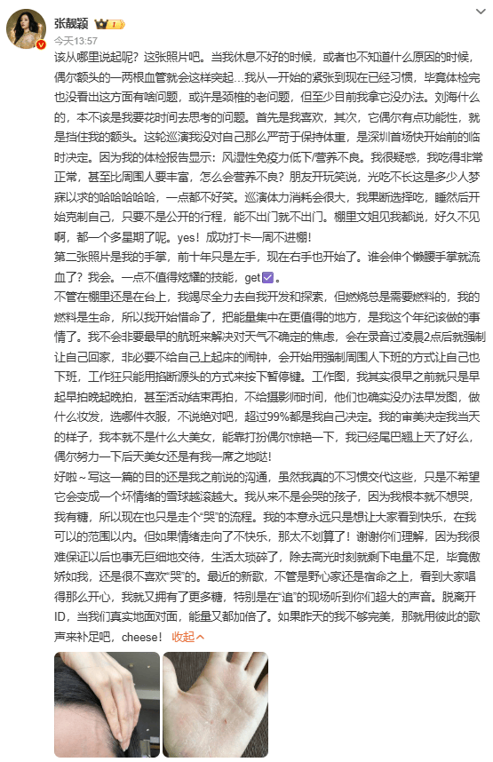 张靓颖演唱会中摔下两米高舞台，后返回继续演唱，暖心安慰歌迷：没事，摔得不疼