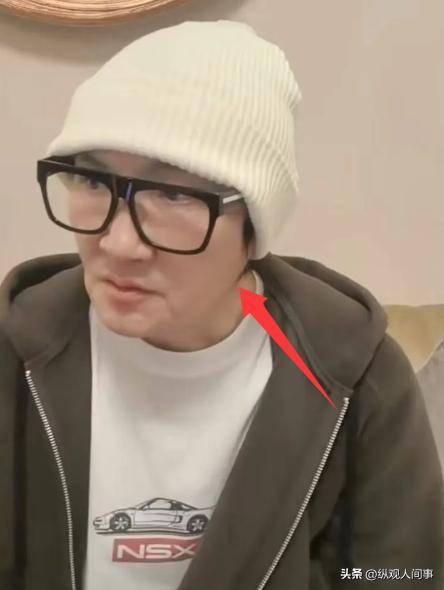 56岁孙楠近况曝光,生图下脸垮锥形下巴,暴瘦后头大身子小引热议