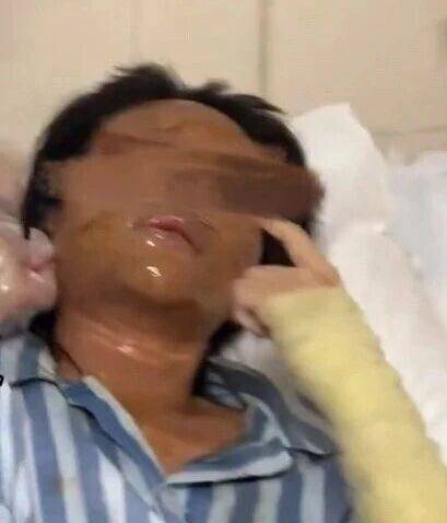 女主播称遭伪装快递包裹炸伤，湖南警方通报：刘某强（男，27岁）已被刑拘