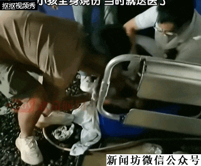 四川攀枝花一男童掉进烧烤店炭堆，全身烧伤！网友：光看就疼得不行