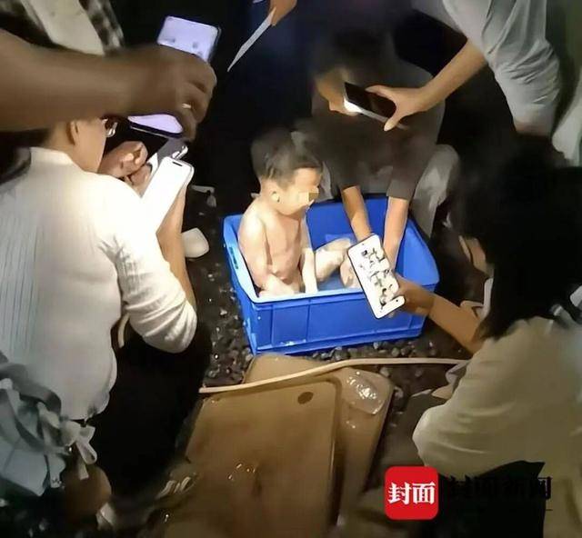 3岁男童掉进炭火堆全身85%烧伤