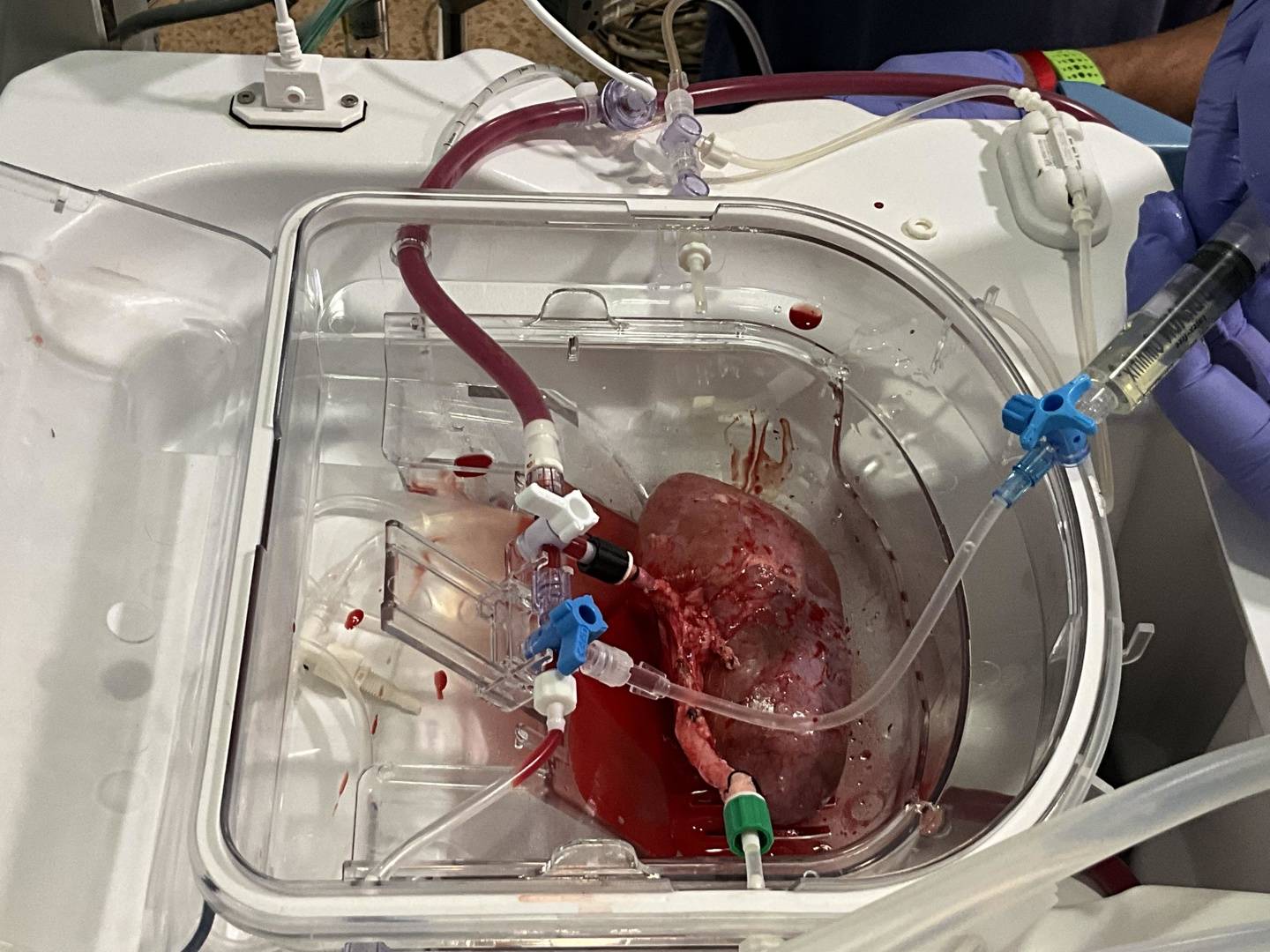 科学家首次将人肾类器官与猪肾实现功能整合，为器官量产及移植带来新希望