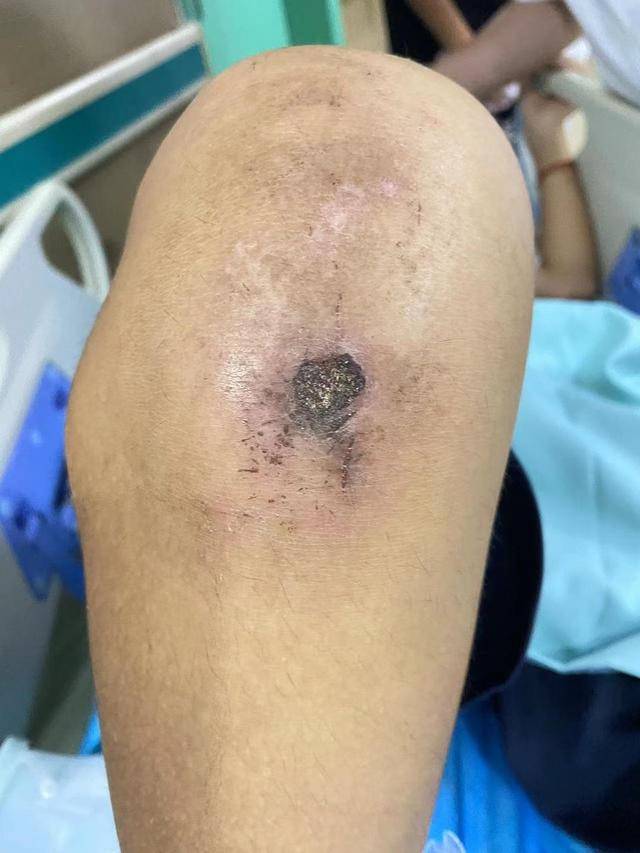 跪举水盆、扇耳光、关小黑屋 男孩在四维基地被虐致重伤二级(图3)