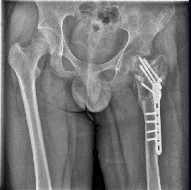 起底"四维成长基地":号称专治厌学、网瘾 动辄殴打关小黑屋(图3)