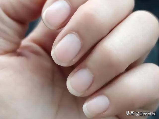 指甲有竖纹是肝不好？易断裂是缺钙？澄清6个指甲传言