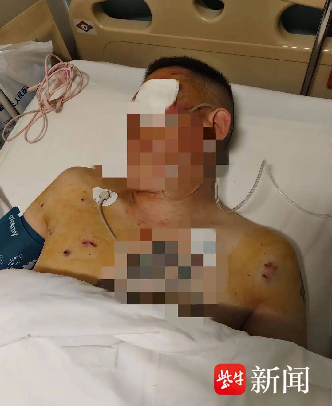 男子取170万在银行门口遭持枪抢劫:工作人员和保安全程观望(图1)