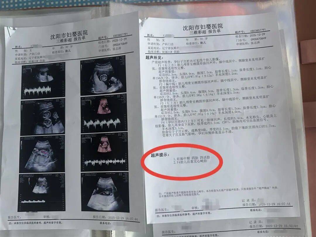 辽宁一孕妇两个月内从一胎变四胞胎