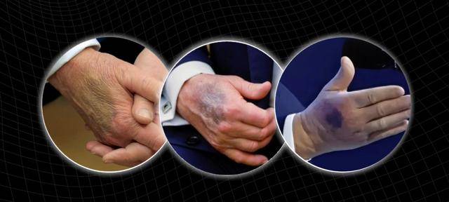 原创            特朗普追捧的“抗衰神药”？为何在严肃临床试验面前集体失灵？