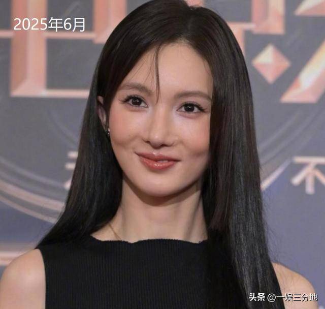 金晨晒满脸血迹的照片道歉,逃逸事件真相大白,却坐实另一个丑闻