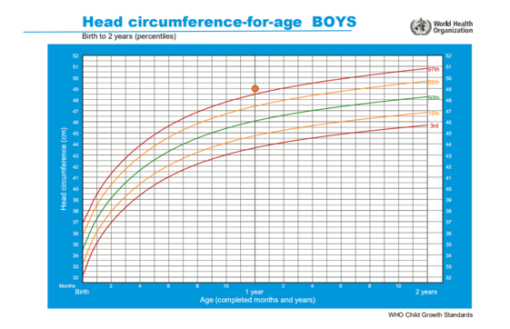 如何判断宝宝头围大小是否正常？