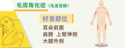 皮肤粗糙像鸡皮？正确改善方法来了
