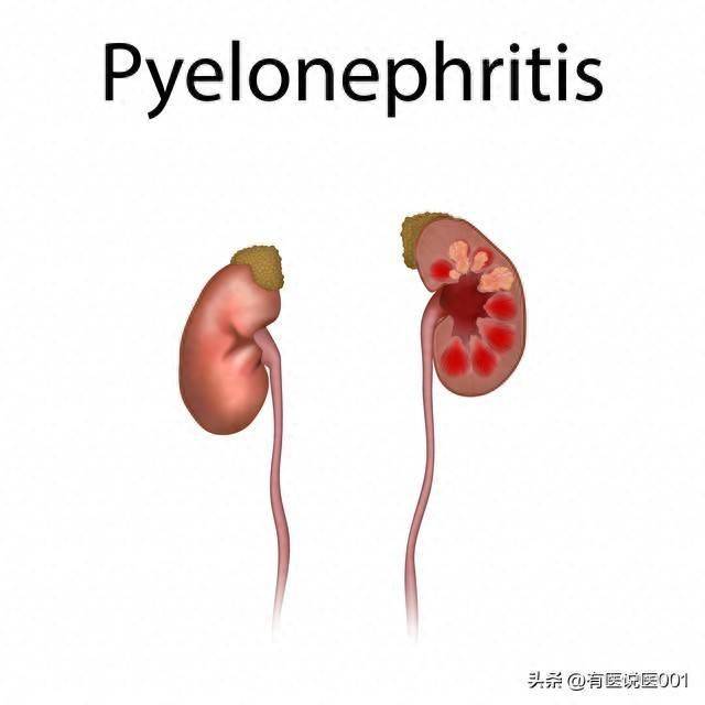 男人一过三十就走下坡路？中医说的肾虚分六种，对照舌象一看便知