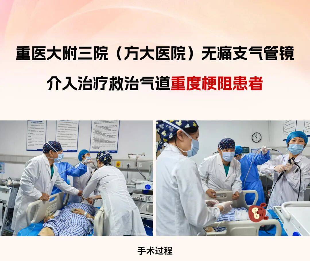 重医大附三院（方大医院）无痛支气管镜介入治疗成功救治气道重度梗阻患者_诊疗_军队_疾病