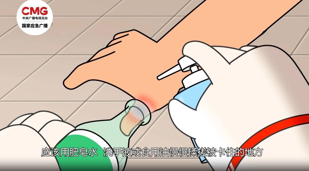 厨房里的这个小洞,千万别用手指去试探!已有人“中招” (pic5) 厨房里的这个小洞,千万别用手指去试探!已有人“中招” (pic5)